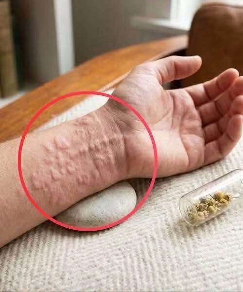 Mój syn zmaga się z tym od dwóch miesięcy i jest coraz gorzej