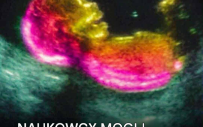 Naukowcy mogli faktycznie odkryć jedną z przyczyn autyzmu