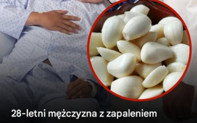 28-letni mężczyzna z zapaleniem nerek jadł czosnek codziennie przez 5 miesięcy – lekarze byli zaskoczeni wynikami jego badań