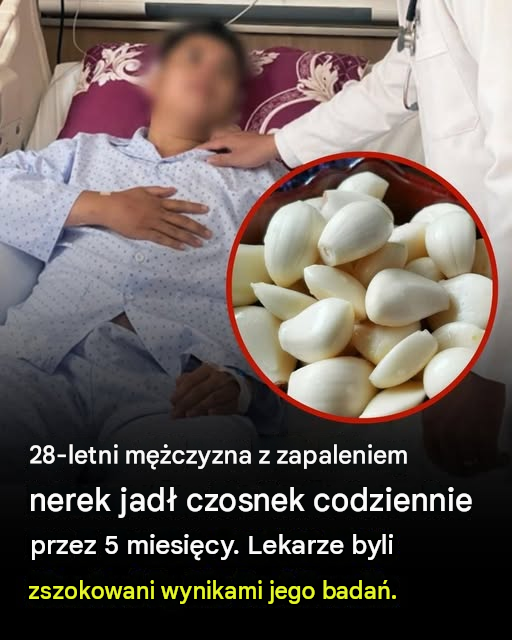 28-letni mężczyzna z zapaleniem nerek jadł czosnek codziennie przez 5 miesięcy – lekarze byli zaskoczeni wynikami jego badań