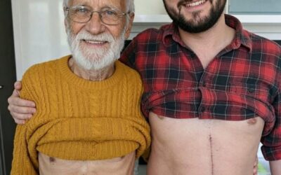 Zrozumienie korzyści i kwestii związanych z oddawaniem wątroby od żywego dawcy