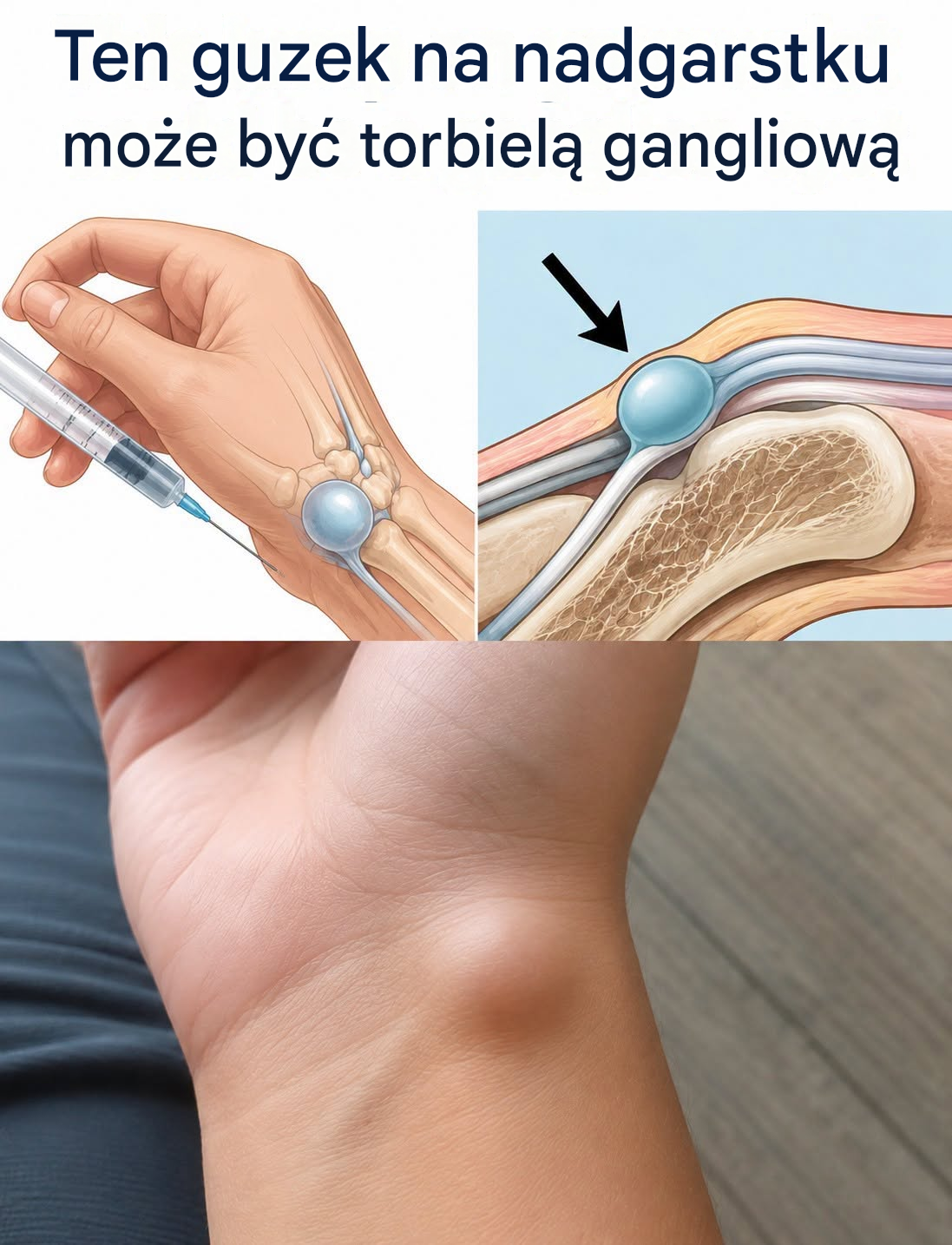 Lecznicza moc i ważne wskazówki dotyczące bezpieczeństwa liści rącznika