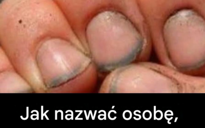 Jak się nazywa osoba z takimi paznokciami?