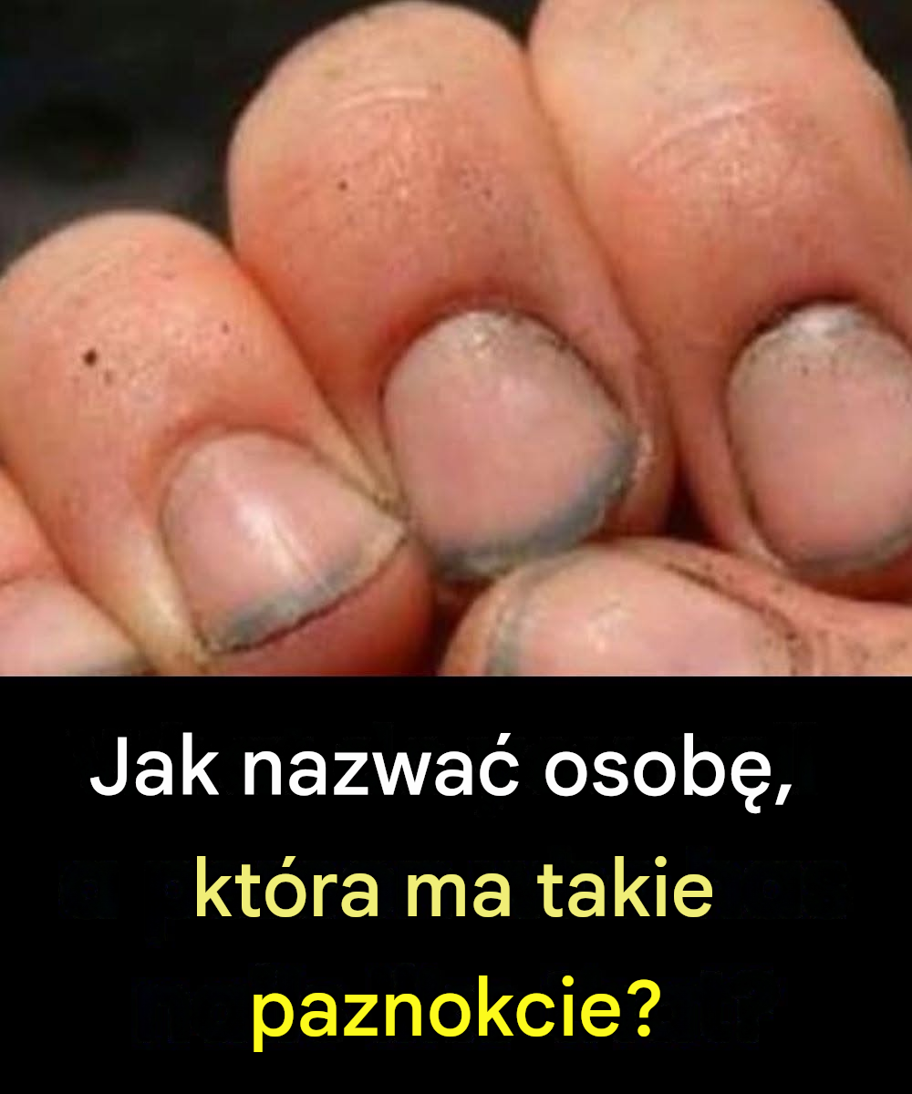 Jak się nazywa osoba z takimi paznokciami?