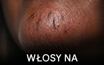 Włosy na brodzie kobiety mogą Ci coś mówić — oto, co mogą oznaczać