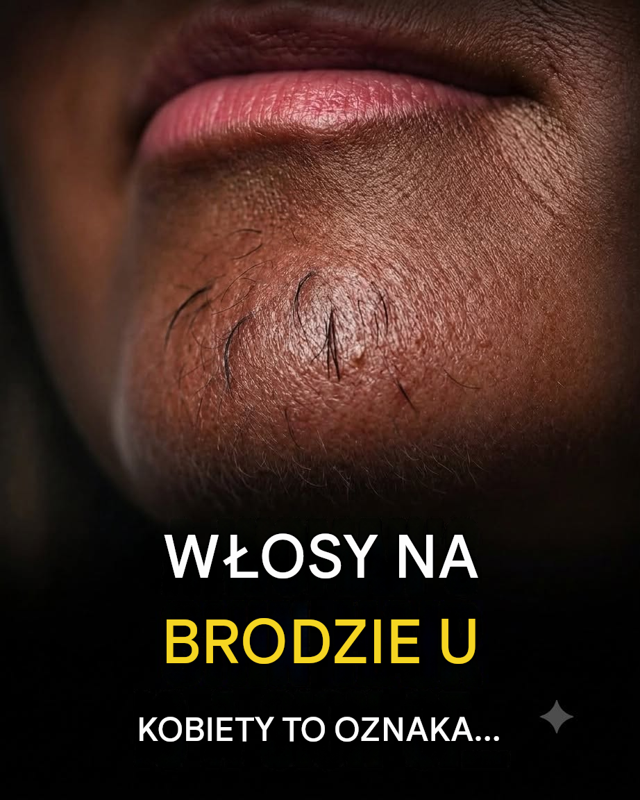 Włosy na brodzie kobiety mogą Ci coś mówić — oto, co mogą oznaczać