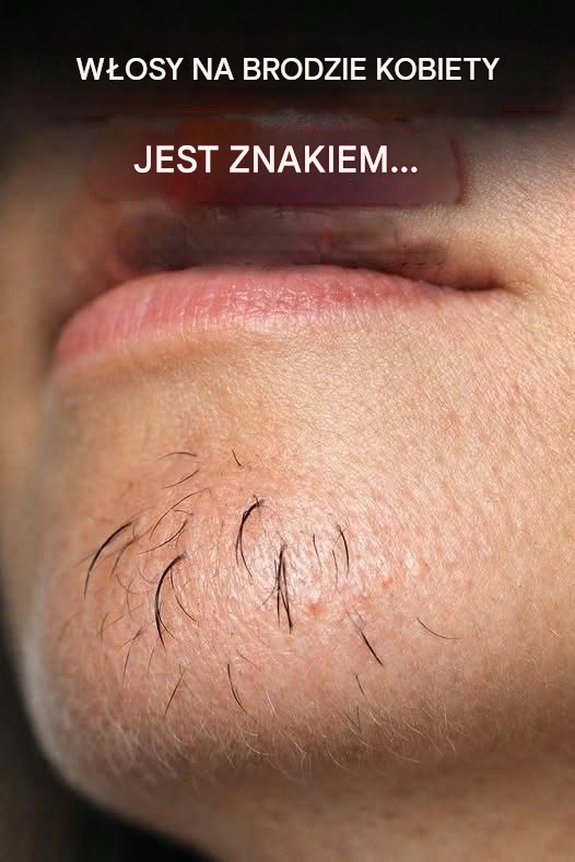 Nagły owłosienie na brodzie: co twoje ciało delikatnie próbuje ci powiedzieć (i jak sobie z tym poradzić z godnością)