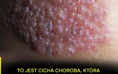 Mało kto wie o tej cichej chorobie, która może pojawić się bez ostrzeżenia