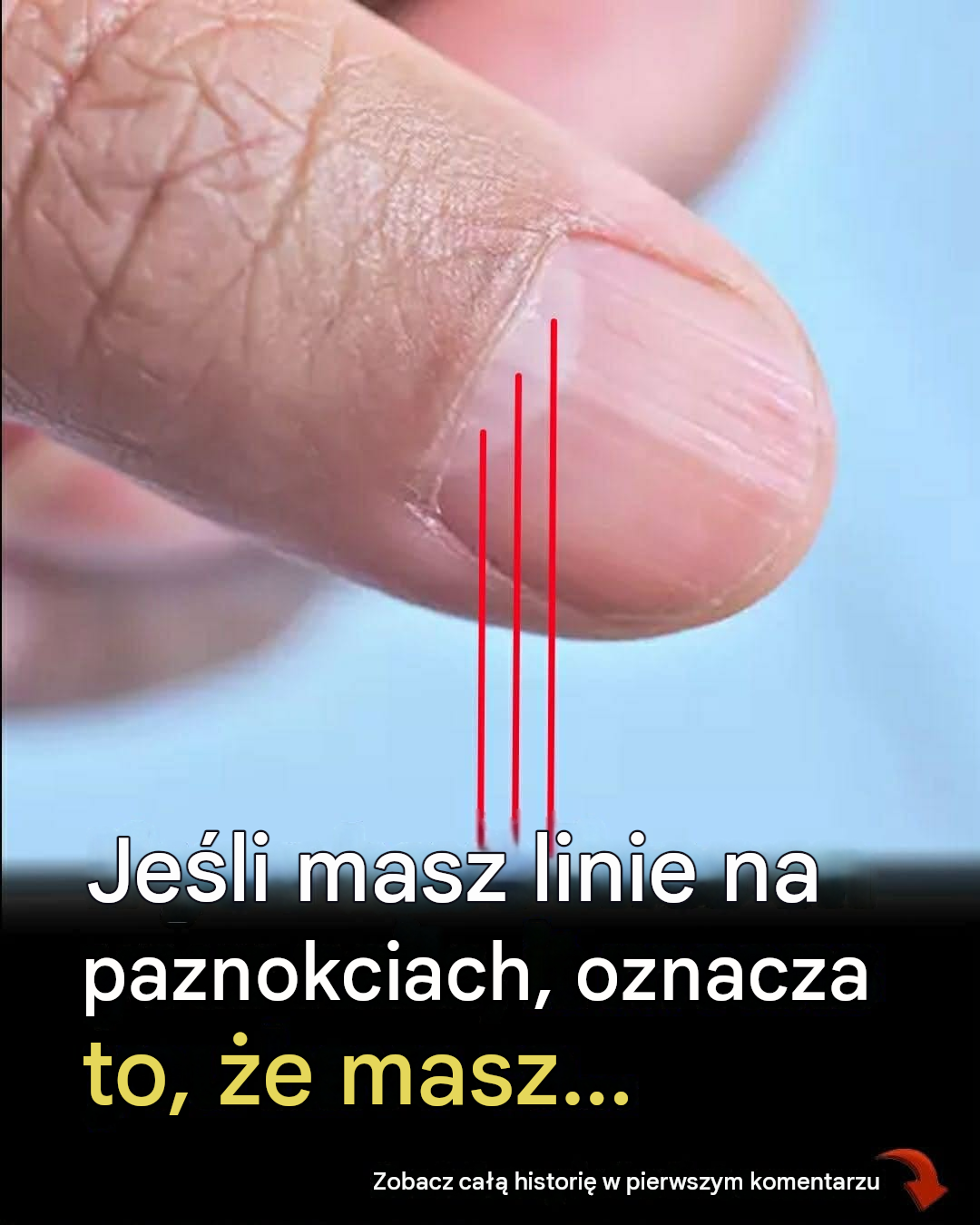 Lekarz odkrył znak rozpoznawczy na paznokciach, który może pomóc przewidzieć długość twojego życia
