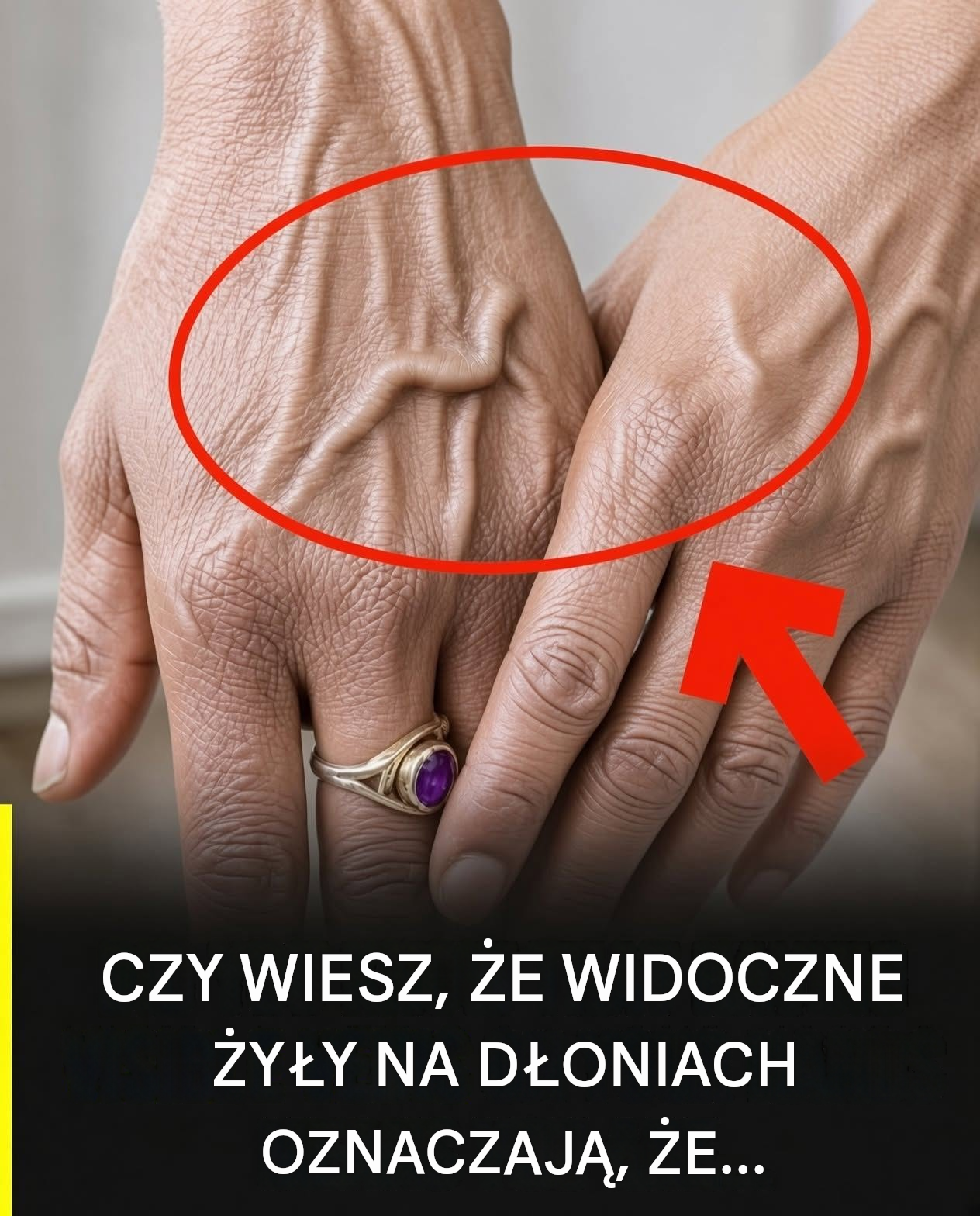 Co naprawdę oznaczają widoczne żyły na dłoniach: oddzielenie faktów od mitów
