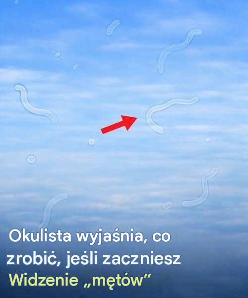 Co zrobić, jeśli zaczniesz widzieć męty w oku