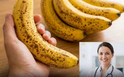 Korzyści ze spożywania bananów i mity, w które powinieneś przestać wierzyć