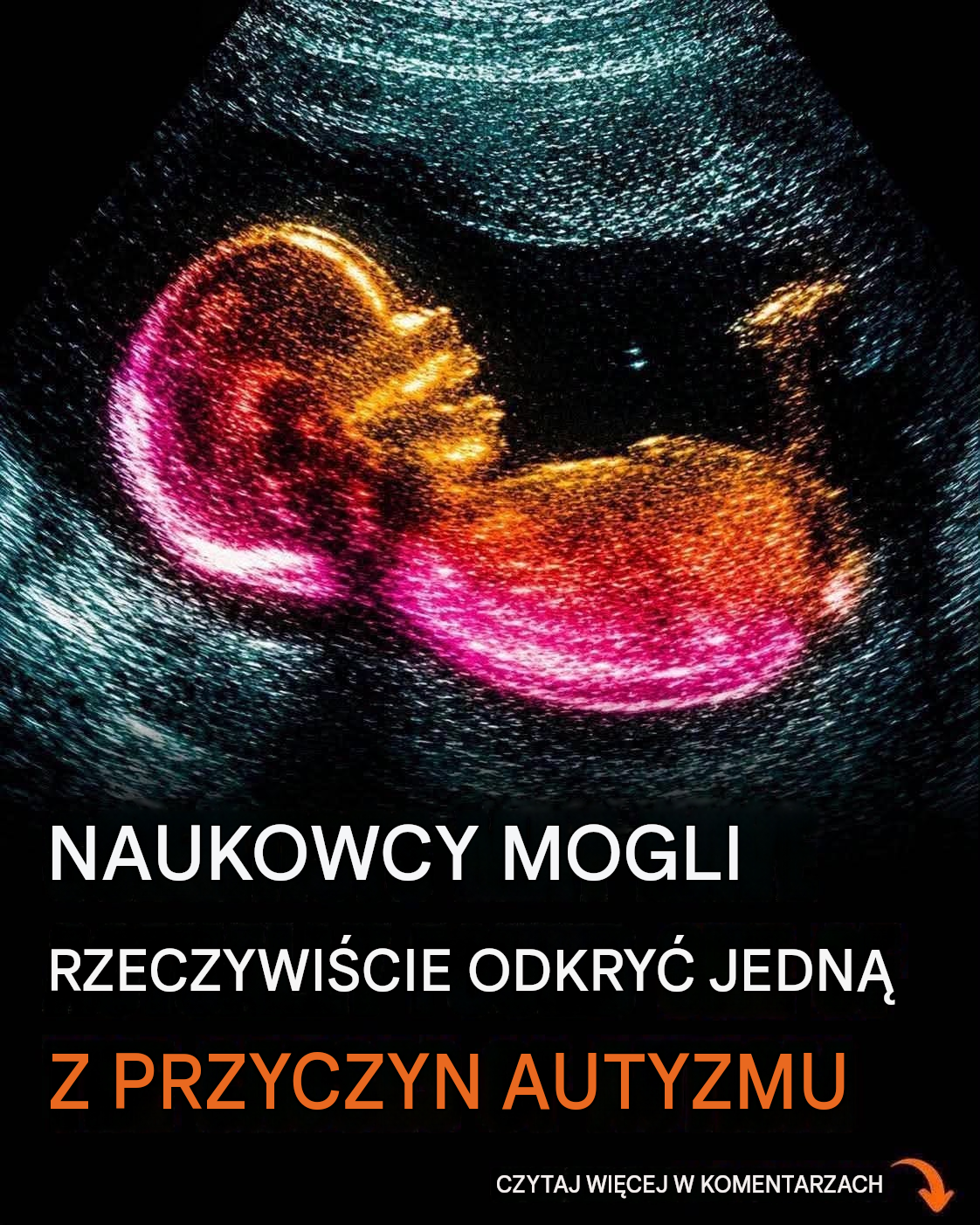 Badanie identyfikuje możliwe powiązanie z rozwojem autyzmu