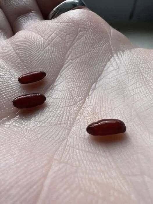 Ostrzeżenie rodziny po nagłej, wyniszczającej chorobie odkleszczowej