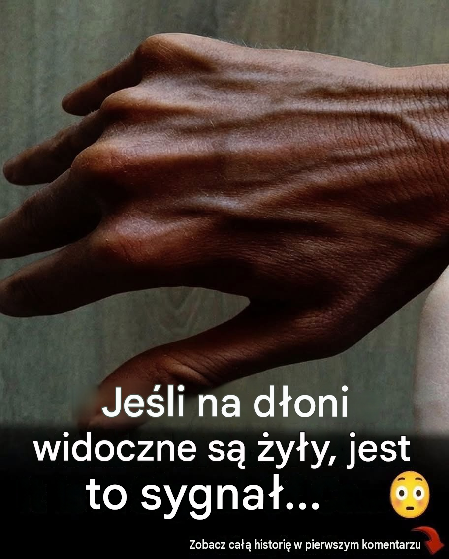 Dlaczego żyły na dłoniach nagle stają się bardziej widoczne? Wyjaśniają eksperci