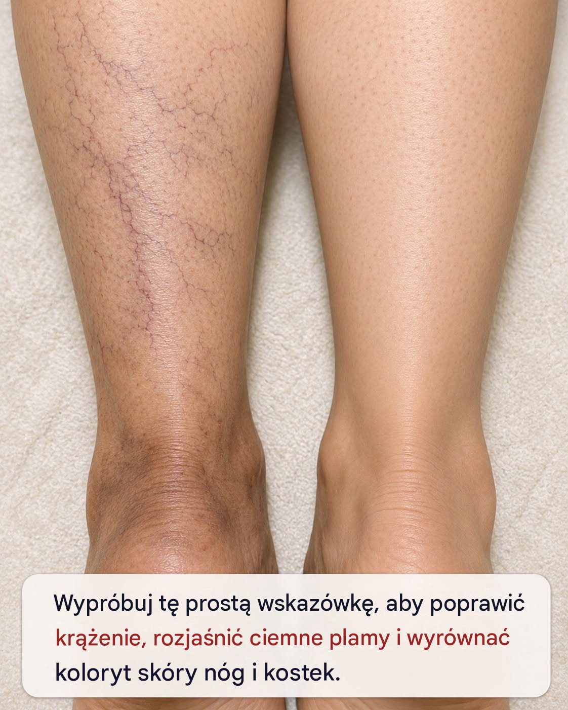 Wmasuj ten jeden trik w swoje nogi i pozbądź się pękniętych naczyń włosowatych, ciemnych kostek i nierównego kolorytu