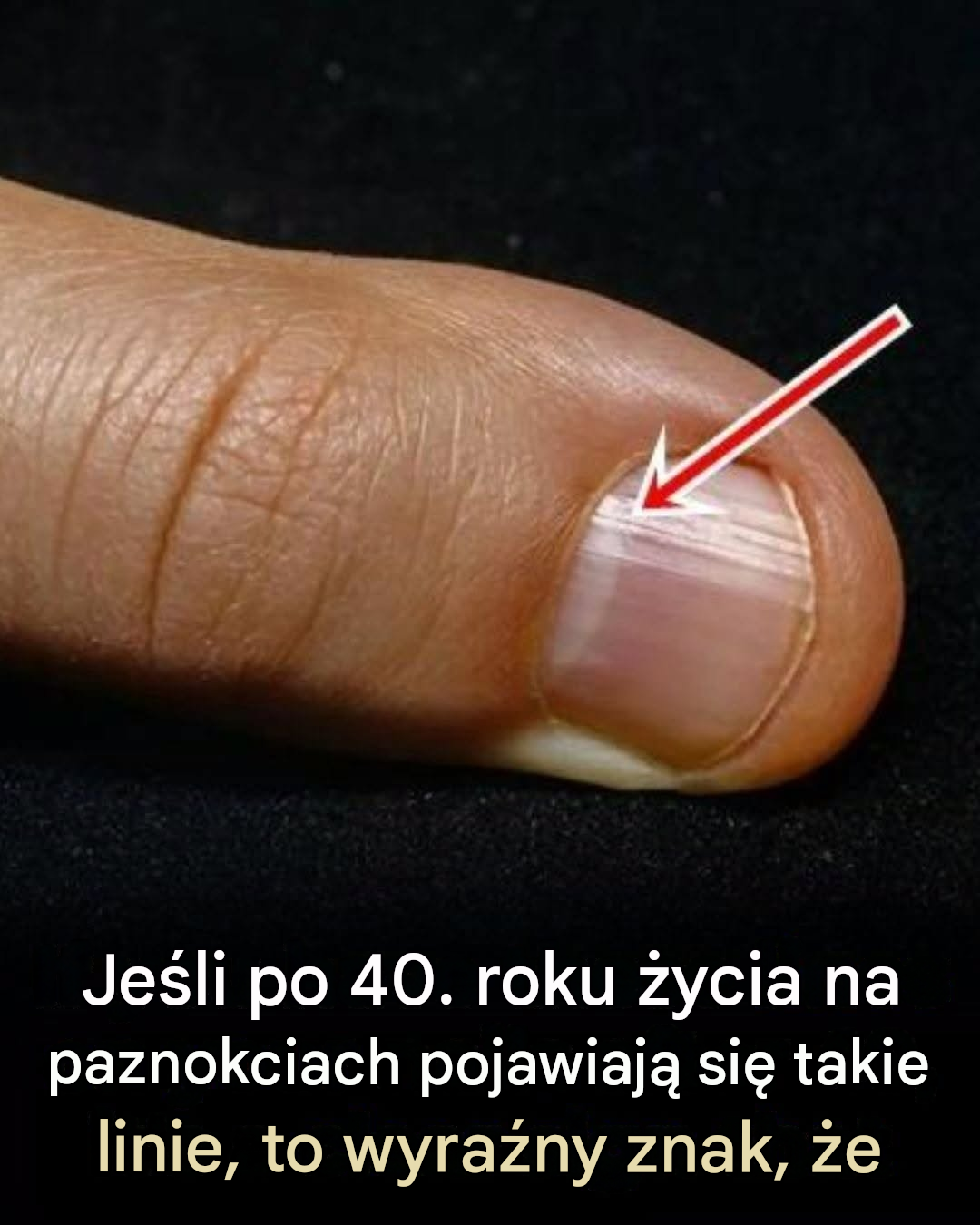 Twoje paznokcie mogą wysyłać sygnały ostrzegawcze – zwłaszcza po 40. roku życia