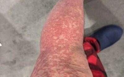 Oto konsekwencje spania z… Zobacz więcej
