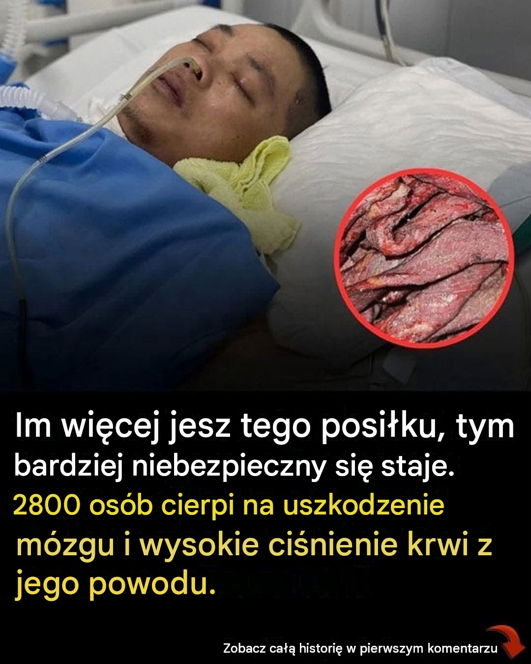 Dlaczego spożywanie większej ilości przetworzonego mięsa zwiększa ryzyko wystąpienia poważnych problemów zdrowotnych