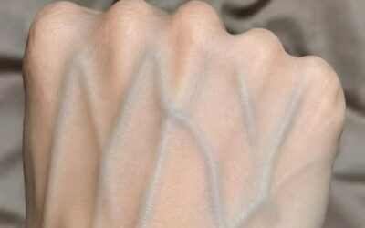 Co tak naprawdę oznaczają widoczne żyły? Zrozumienie przyczyn i kiedy zwrócić uwagę