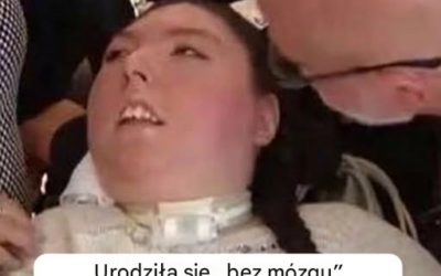 Urodzona bez mózgu Alex świętuje swoje 20. urodziny. Oto niesamowita historia młodej kobiety, która pokonała wszelkie przeciwności.