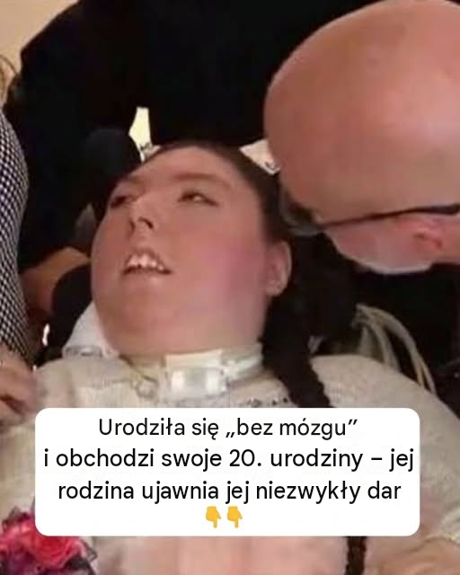 Urodzona bez mózgu Alex świętuje swoje 20. urodziny. Oto niesamowita historia młodej kobiety, która pokonała wszelkie przeciwności.