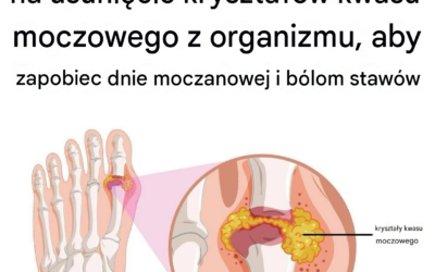 Jak naturalnie złagodzić dnę moczanową i ból stawów