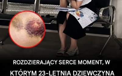 23-letnia kobieta z białaczką załamała się na korytarzu szpitalnym