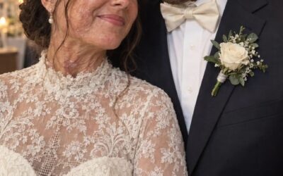 Wyszłam za niewidomego mężczyznę, żeby nigdy nie zobaczył moich blizn — ale w noc poślubną wyjawił sekret, który łączył go z eksplozją, która zniszczyła moje życie 😱💔