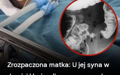 Rozpacz matki: U dziecka zdiagnozowano raka jelita grubego po latach niezdrowych nawyków żywieniowych