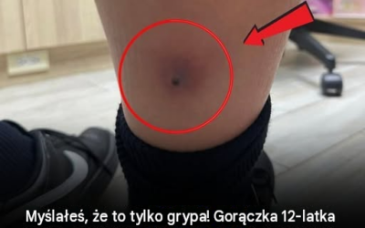 Gorączka u chłopca przypominała grypę — dopóki lekarze nie odkryli niebezpiecznego sygnału ostrzegawczego