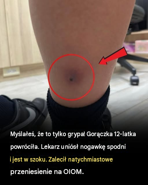 Gorączka u chłopca przypominała grypę — dopóki lekarze nie odkryli niebezpiecznego sygnału ostrzegawczego