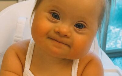 Kiedy lekarz powiedział: „Państwa dziecko ma zespół Downa”, jej mama zaczęła płakać… Ale kilka miesięcy później ta mała dziewczynka odmieniła serca wszystkich