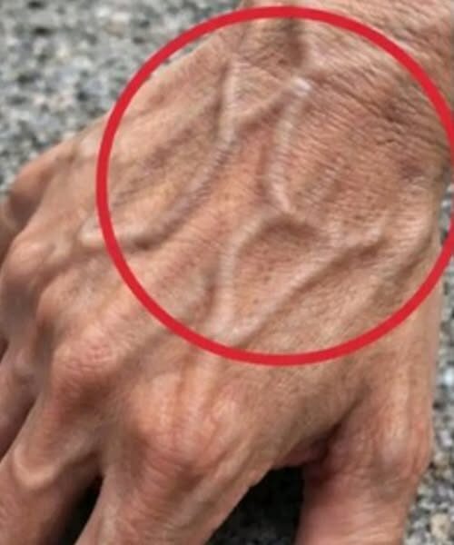 Jeżeli masz widoczne żyły, oznacza to, że jesteś...