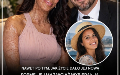 „Poślubiłem jej duszę, nie wygląd”: niezwykła historia Turii Pitt i Michaela Hoskina o miłości, lojalności i odporności