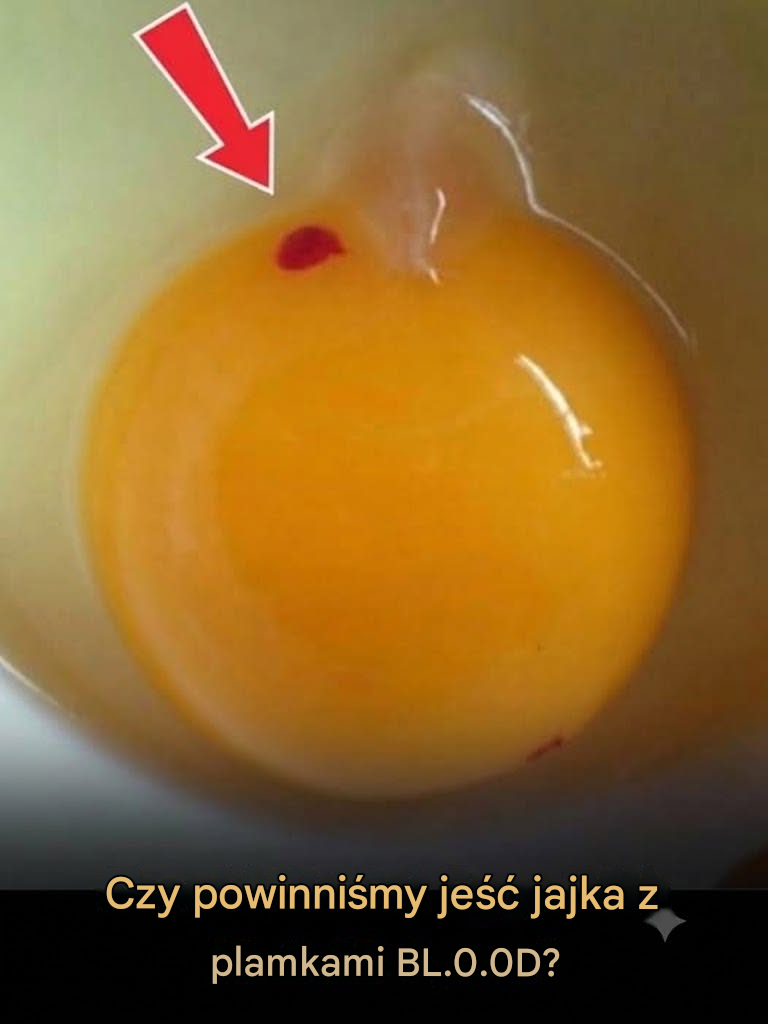 Plamy krwi w jajach: niegroźna wada czy znak ostrzegawczy?