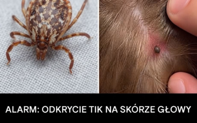 Znalazłeś coś pełzającego we włosach swojego dziecka