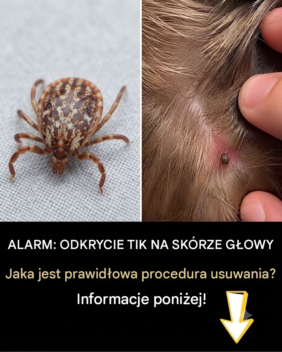 Znalazłeś coś pełzającego we włosach swojego dziecka
