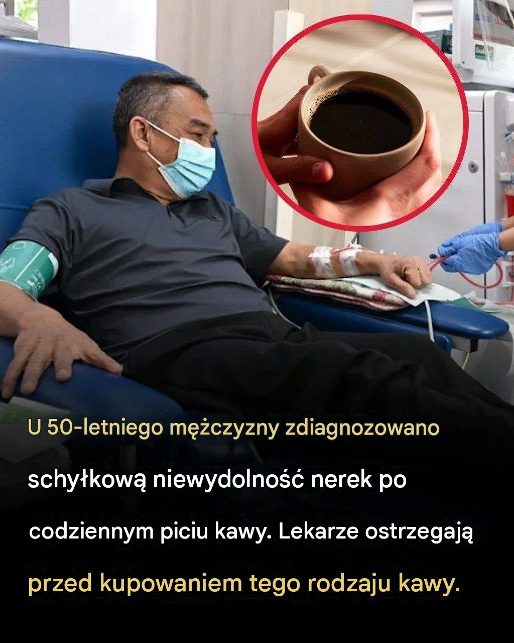 Diagnoza niewydolności nerek u 50-letniego mężczyzny budzi wątpliwości co do codziennych nawyków związanych z piciem kawy