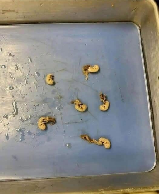 Uważaj na „nasiona w przekąskach”: jakie ukryte zagrożenia mogą czyhać w codziennych produktach spożywczych