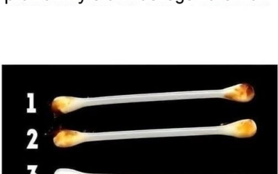 Nasze uszy ujawniają prawdziwy stan naszego zdrowia