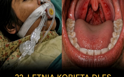 Myślała, że to tylko ból gardła — pięć dni później straciła życie