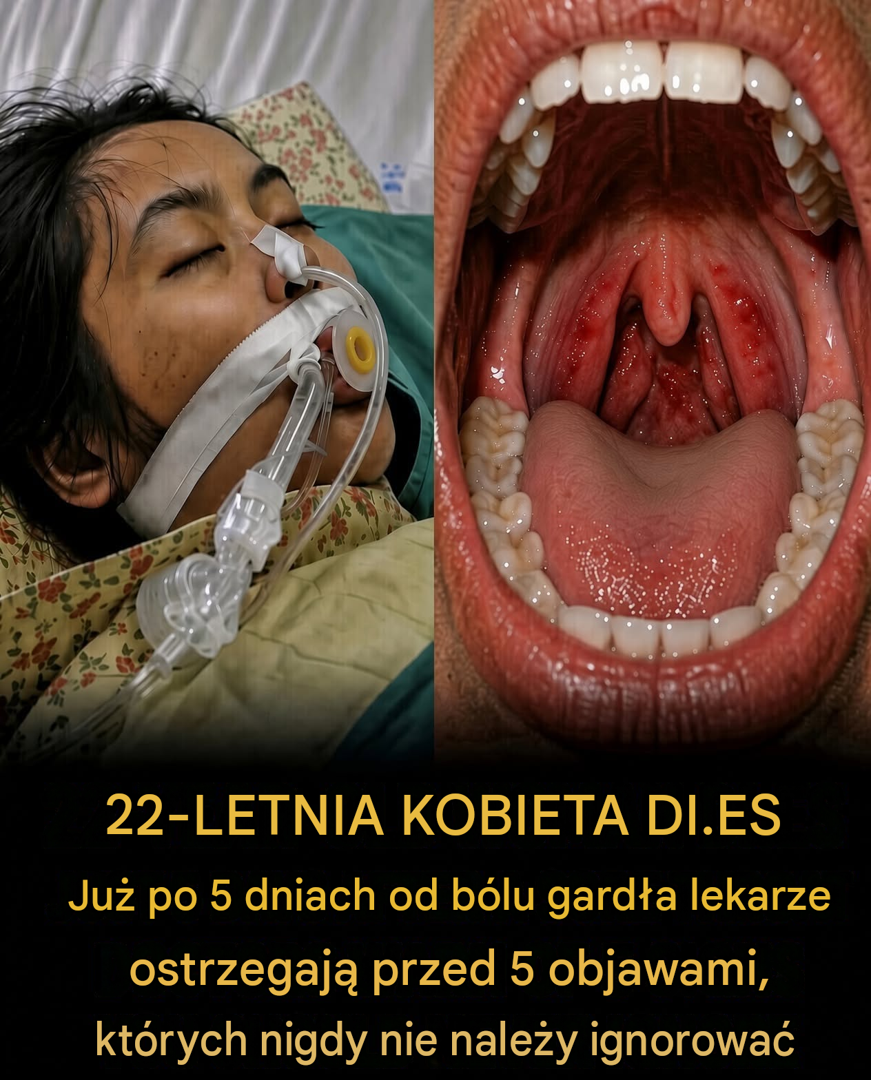 Myślała, że to tylko ból gardła — pięć dni później straciła życie