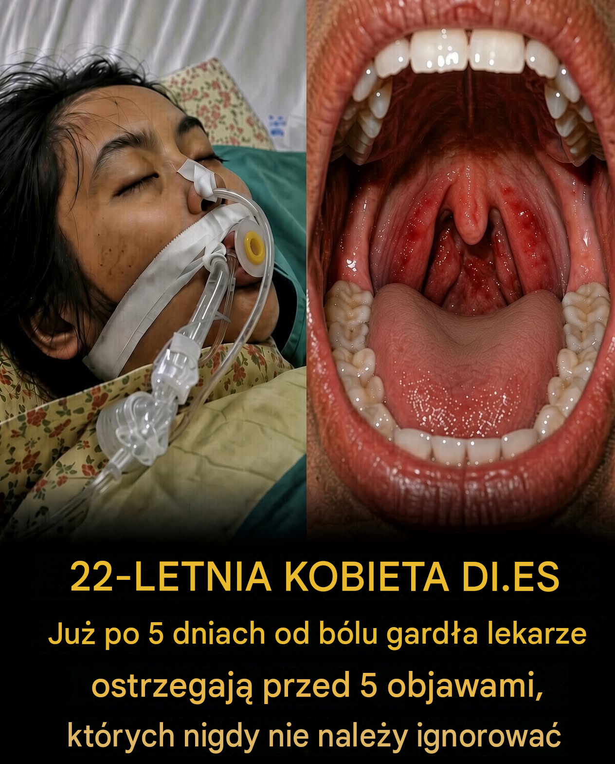 Myślała, że to tylko ból gardła — pięć dni później straciła życie