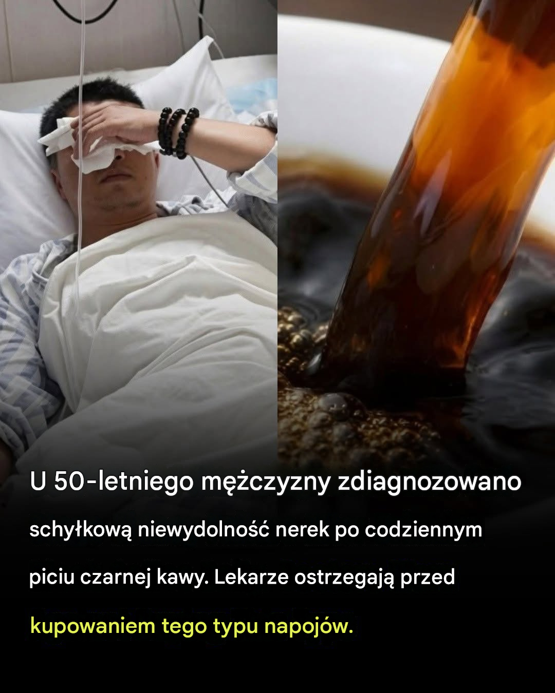 U 50-letniego mężczyzny zdiagnozowano zaawansowaną niewydolność nerek – lekarze twierdzą, że jego codzienne picie kawy to nie wszystko