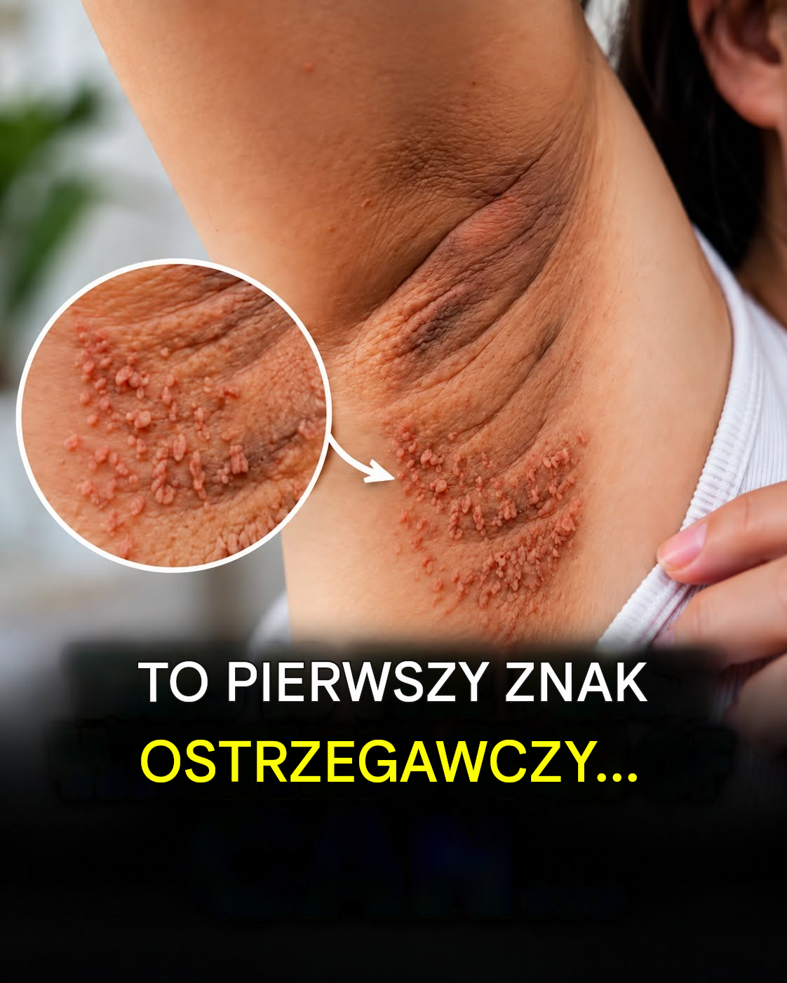 Może to być wczesny znak ostrzegawczy ukryty na widoku