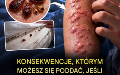 Ukryte konsekwencje spania z pluskwami bez zdawania sobie z tego sprawy