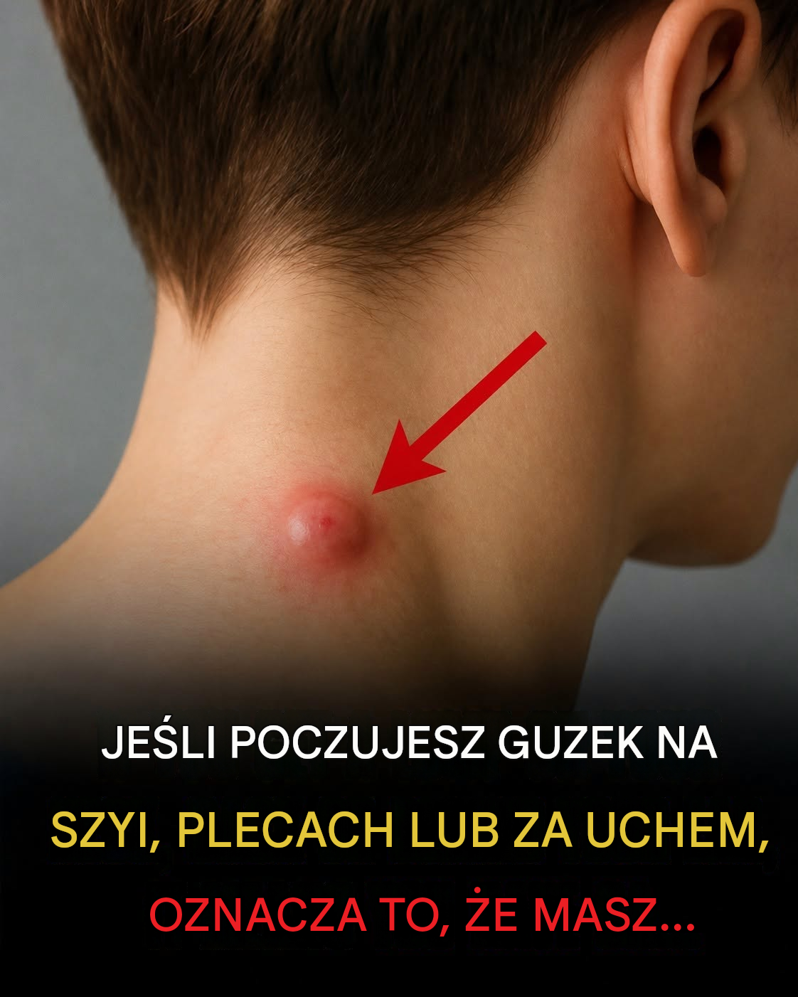 Znalazłeś guzek na szyi? Oto, co lekarze chcą Ci powiedzieć Rozdział 1
