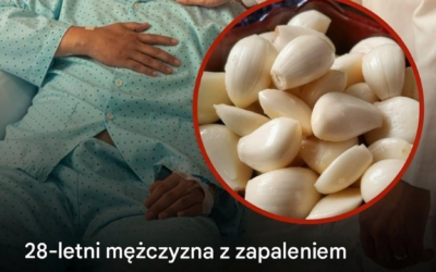 Jadł czosnek codziennie przez 5 miesięcy – to, co stało się z jego nerkami, zaskoczyło lekarzy