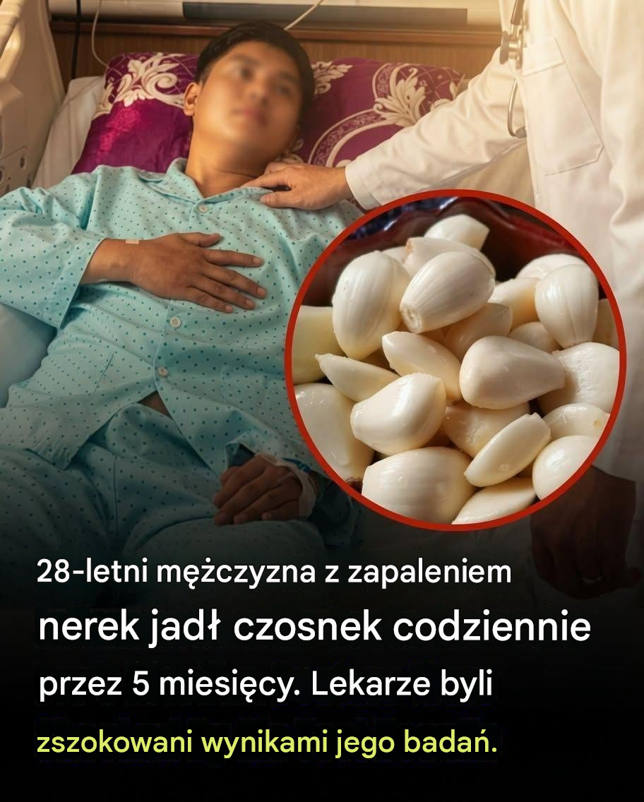 Jadł czosnek codziennie przez 5 miesięcy – to, co stało się z jego nerkami, zaskoczyło lekarzy